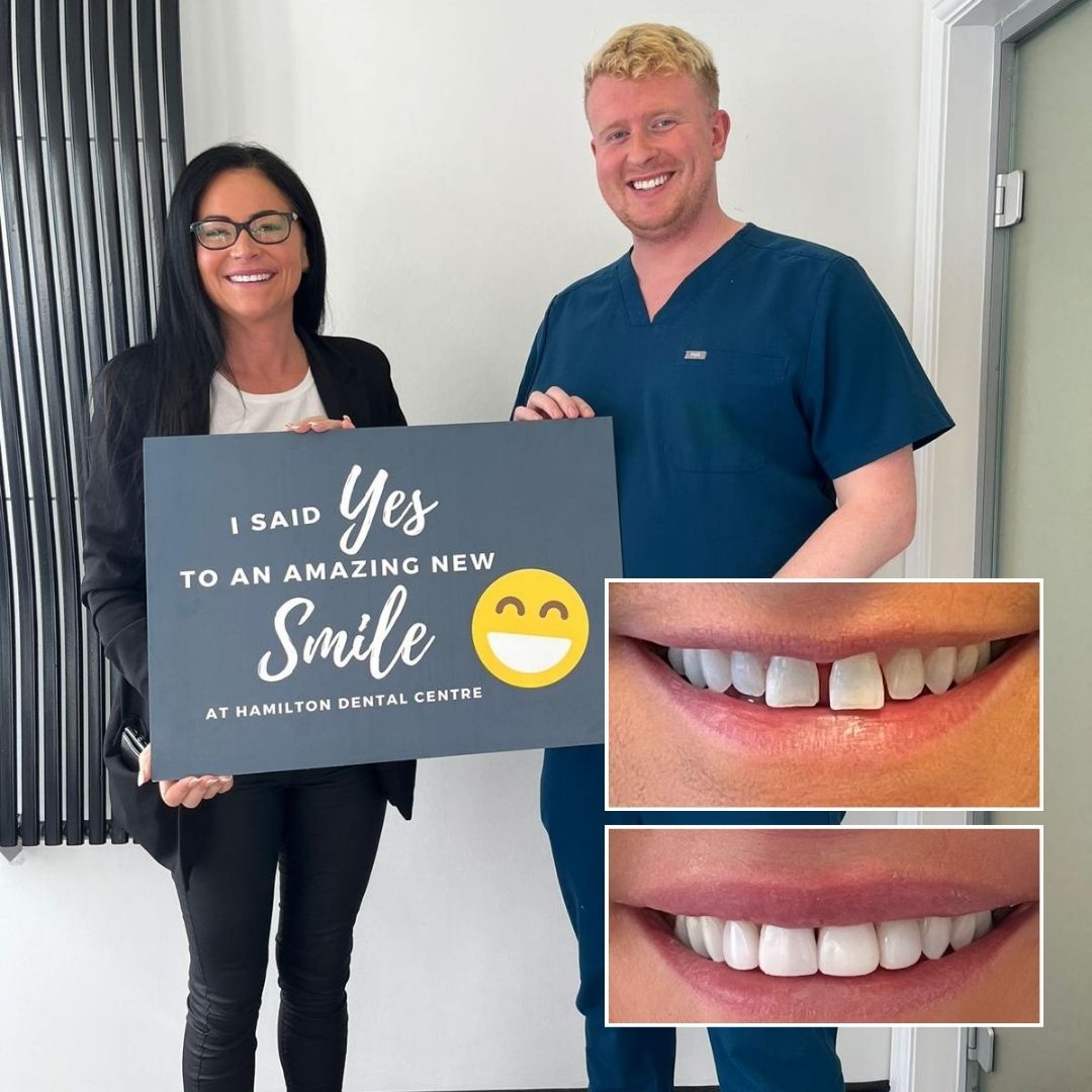 Frequently Asked Questions Hamilton Dental Practice