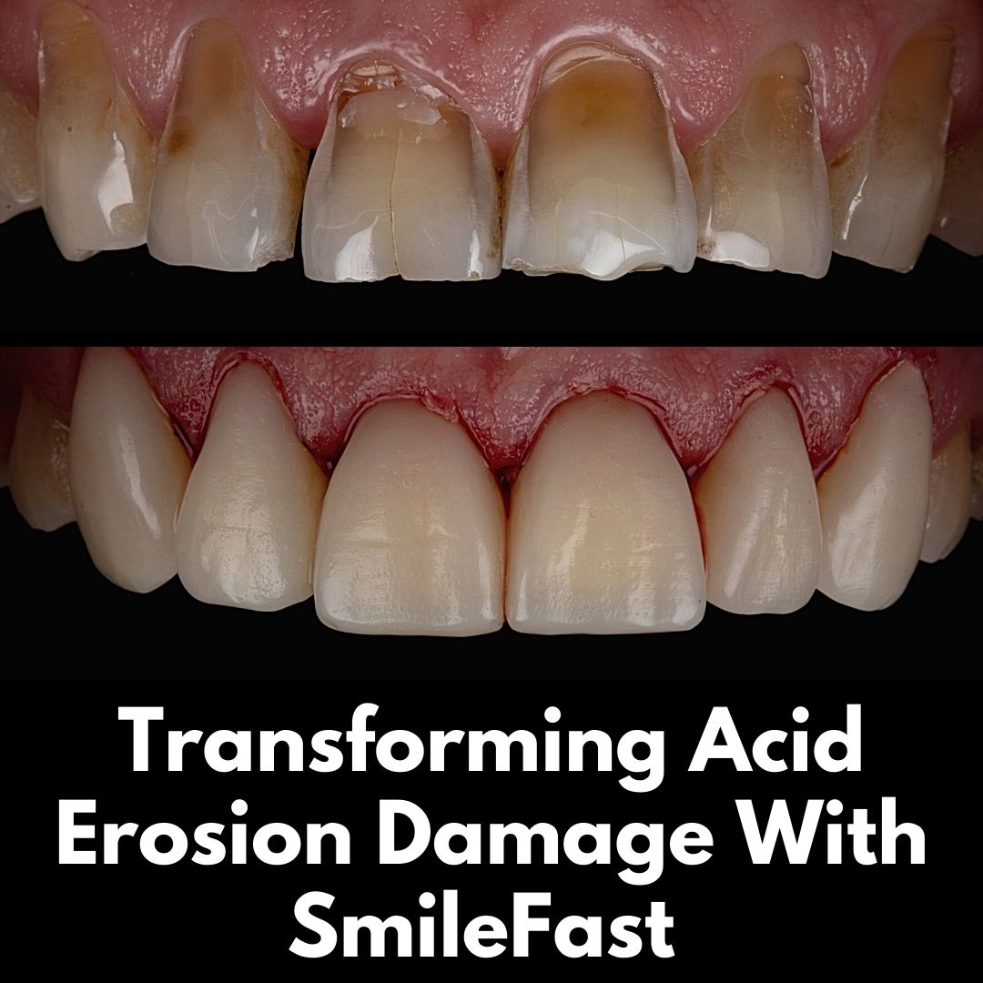 Hamilton Dental Centre SmileFast Hamilton Dental Centre SmileFast