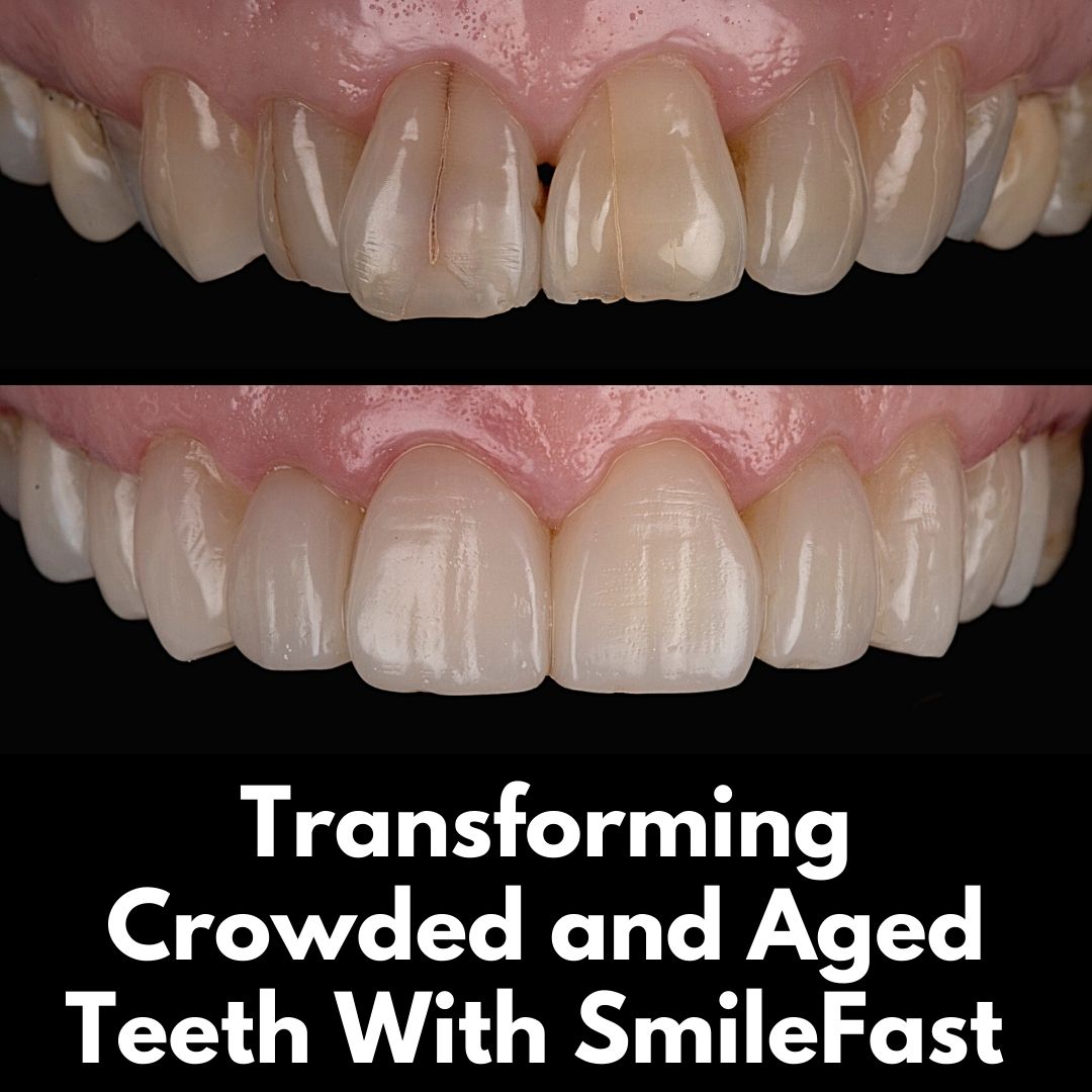 Hamilton Dental Centre SmileFast Hamilton Dental Centre SmileFast