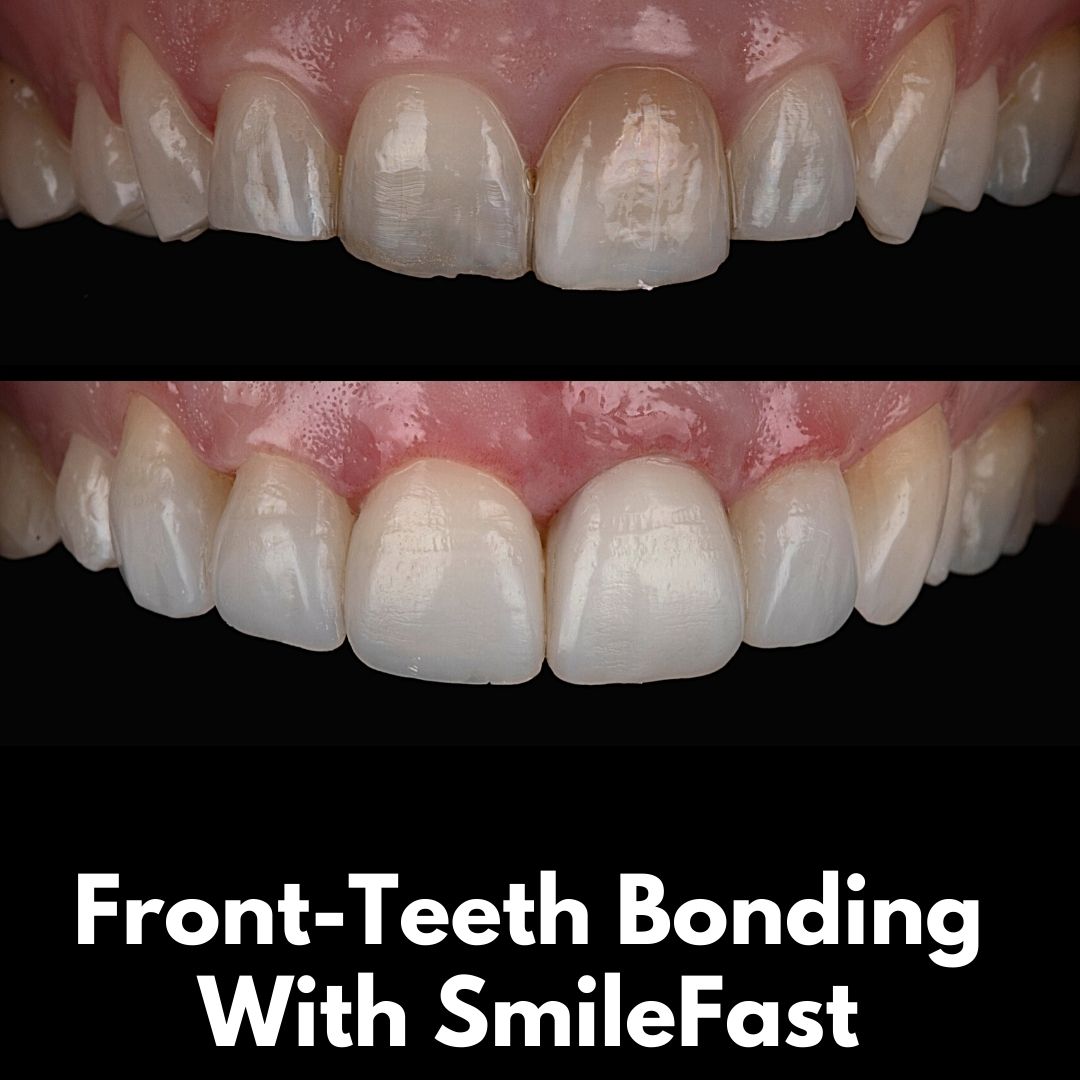 Hamilton Dental Centre SmileFast Hamilton Dental Centre SmileFast