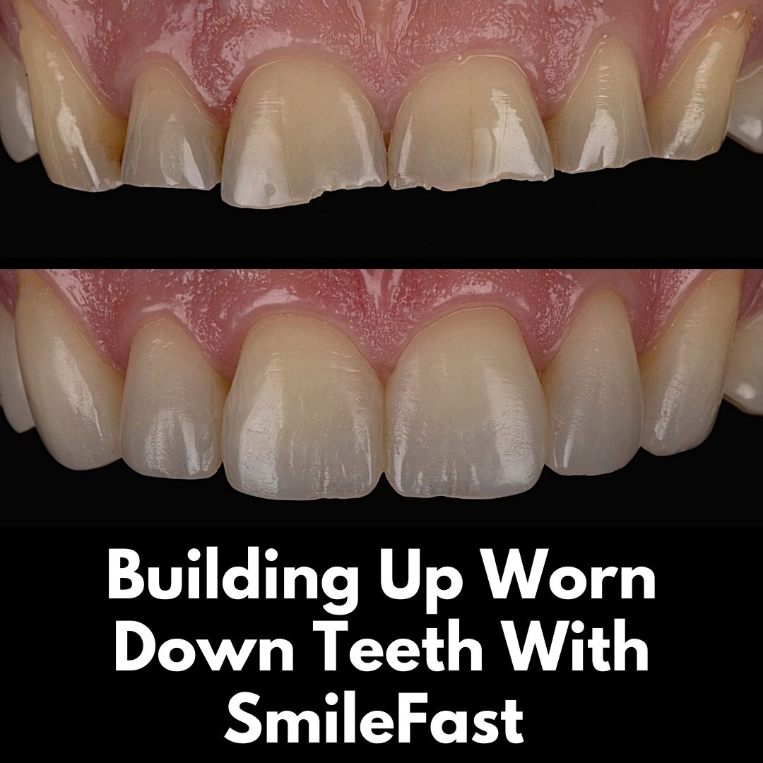 Hamilton Dental Centre SmileFast Hamilton Dental Centre SmileFast