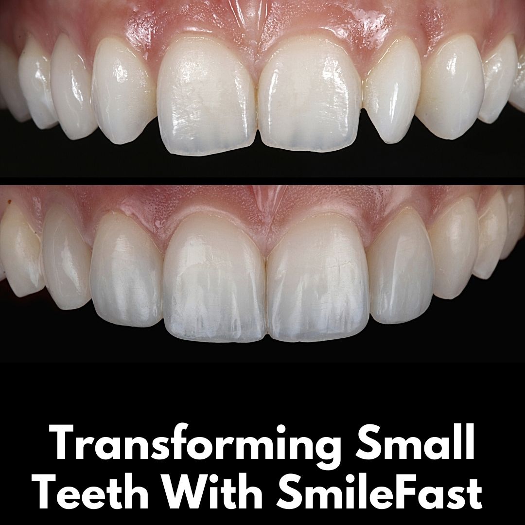 Hamilton Dental Centre SmileFast Hamilton Dental Centre SmileFast