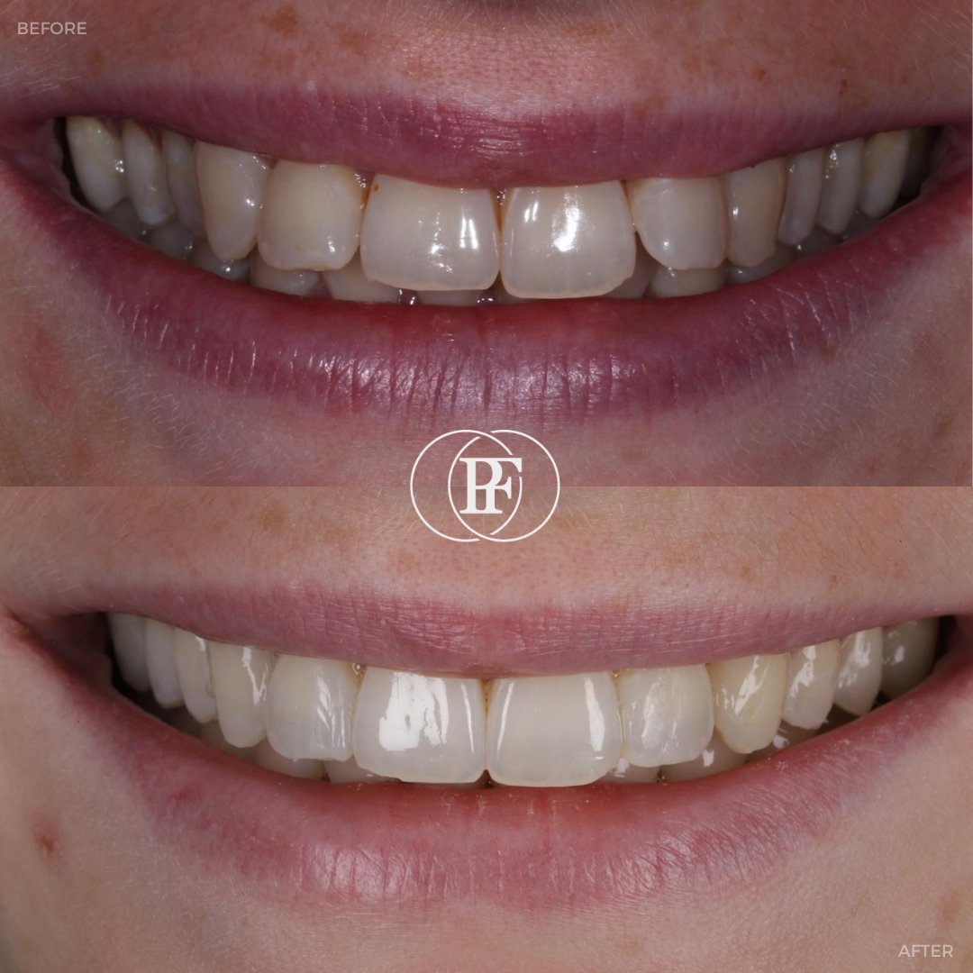 Hamilton Dental Centre Request A Complimentary Consultation Hamilton Dental Centre Request A Complimentary Consultation