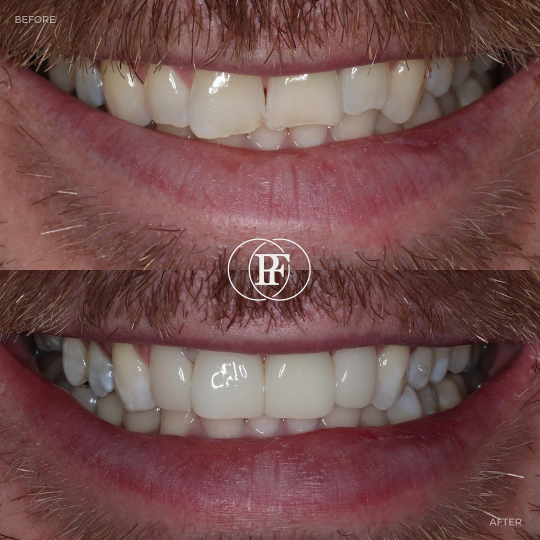 Hamilton Dental Centre Request A Complimentary Consultation Hamilton Dental Centre Request A Complimentary Consultation