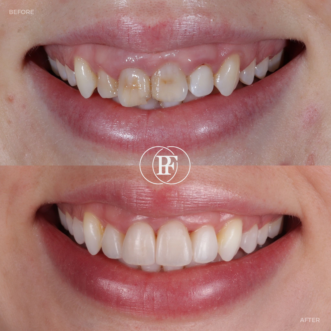 Hamilton Dental Centre Request A Complimentary Consultation Hamilton Dental Centre Request A Complimentary Consultation