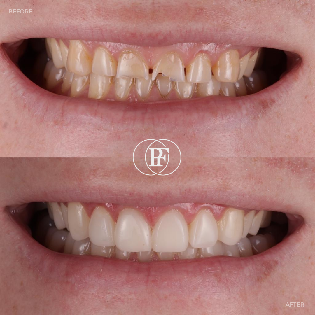 Hamilton Dental Centre Request A Complimentary Consultation Hamilton Dental Centre Request A Complimentary Consultation