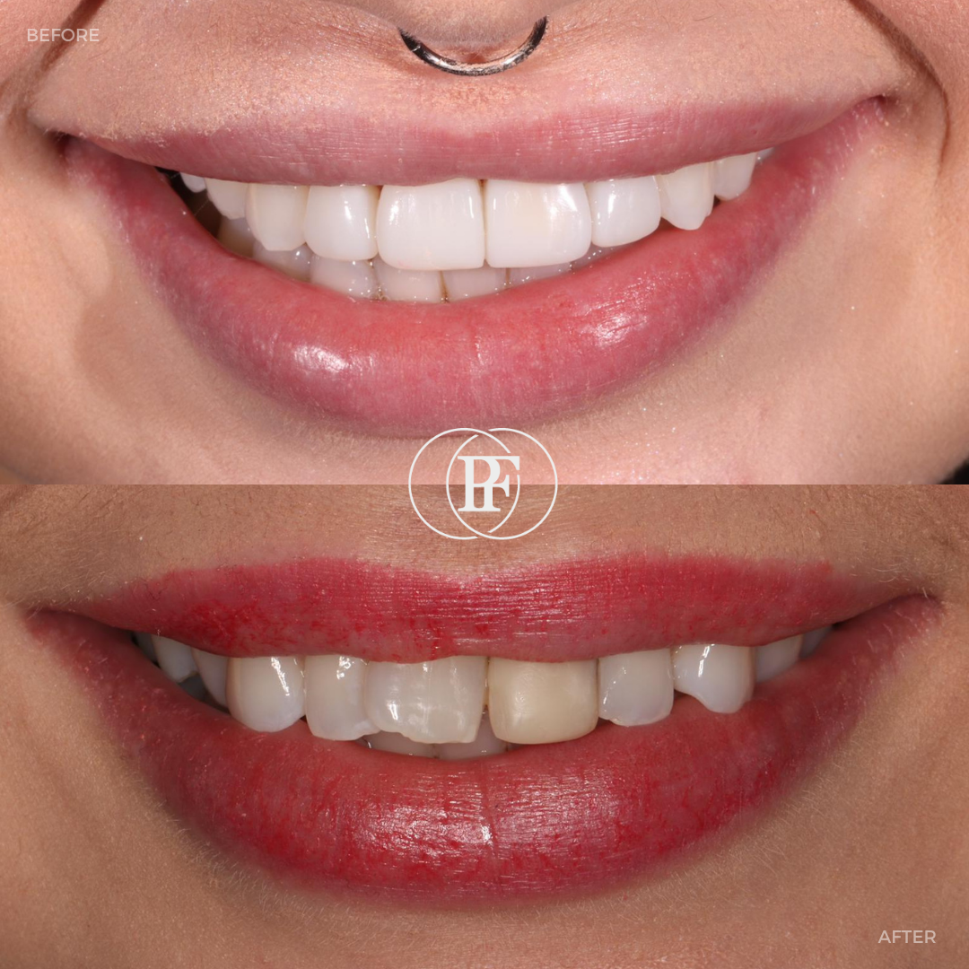 Hamilton Dental Centre Request A Complimentary Consultation Hamilton Dental Centre Request A Complimentary Consultation