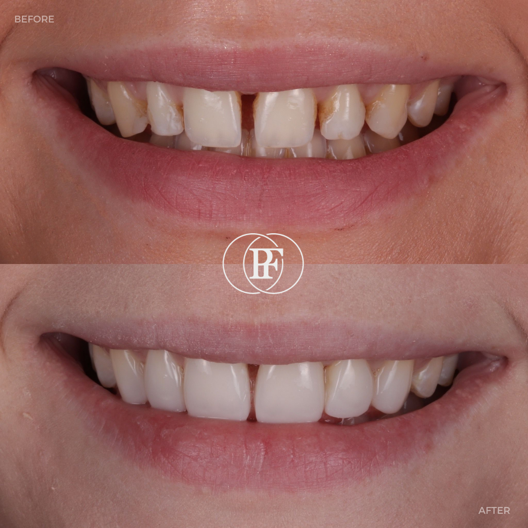 Hamilton Dental Centre Request A Complimentary Consultation Hamilton Dental Centre Request A Complimentary Consultation