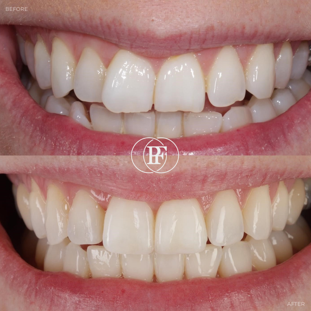 Hamilton Dental Centre Request A Complimentary Consultation Hamilton Dental Centre Request A Complimentary Consultation