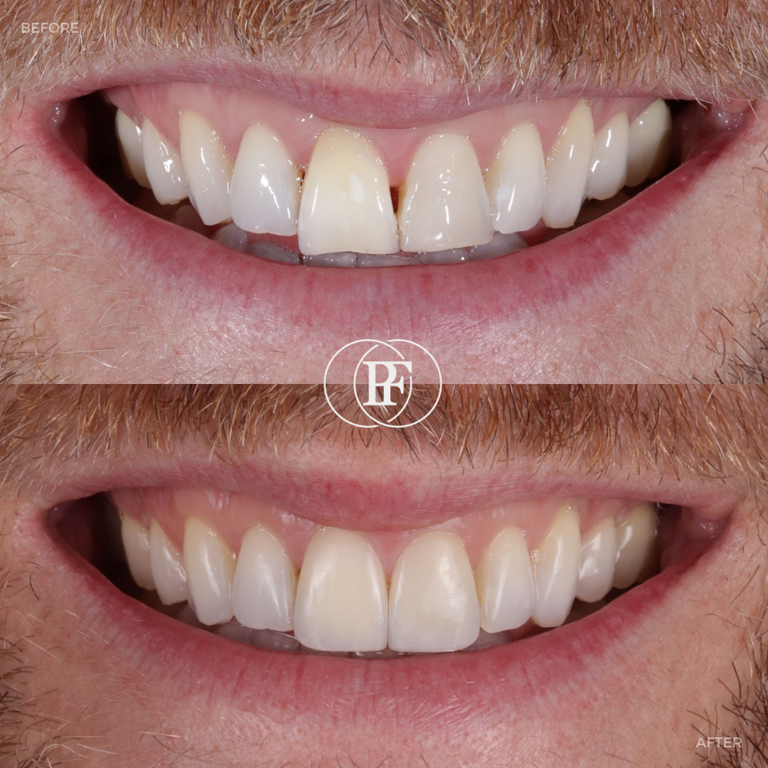 Hamilton Dental Centre Request A Complimentary Consultation Hamilton Dental Centre Request A Complimentary Consultation