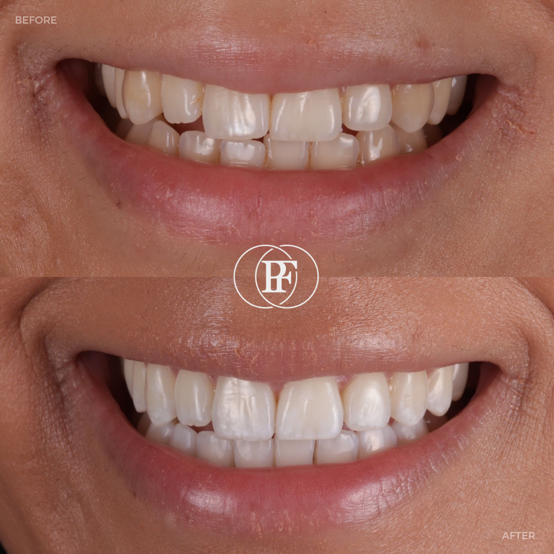 Hamilton Dental Centre Request A Complimentary Consultation Hamilton Dental Centre Request A Complimentary Consultation