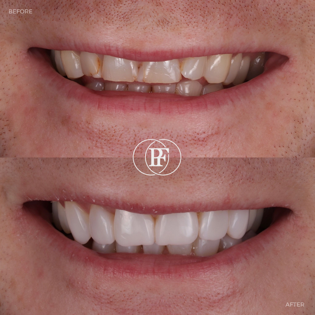 Hamilton Dental Centre Request A Complimentary Consultation Hamilton Dental Centre Request A Complimentary Consultation