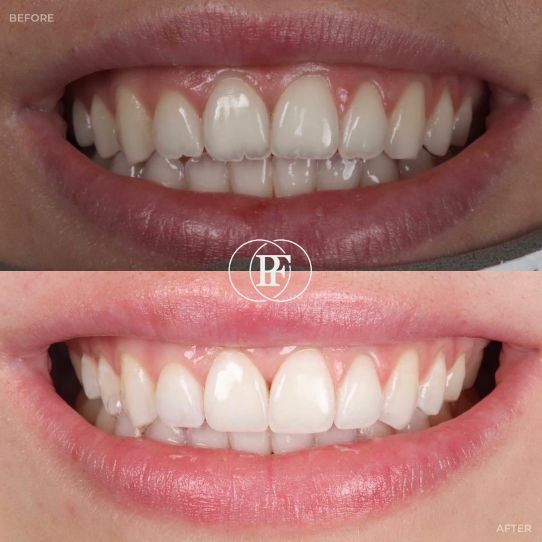 Hamilton Dental Centre Request A Complimentary Consultation Hamilton Dental Centre Request A Complimentary Consultation