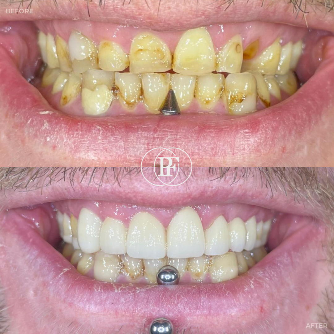 Hamilton Dental Centre Smile Gallery Hamilton Dental Centre Smile Gallery