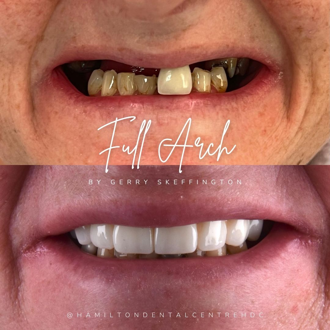 Hamilton Dental Centre Hamilton Dental Centre
