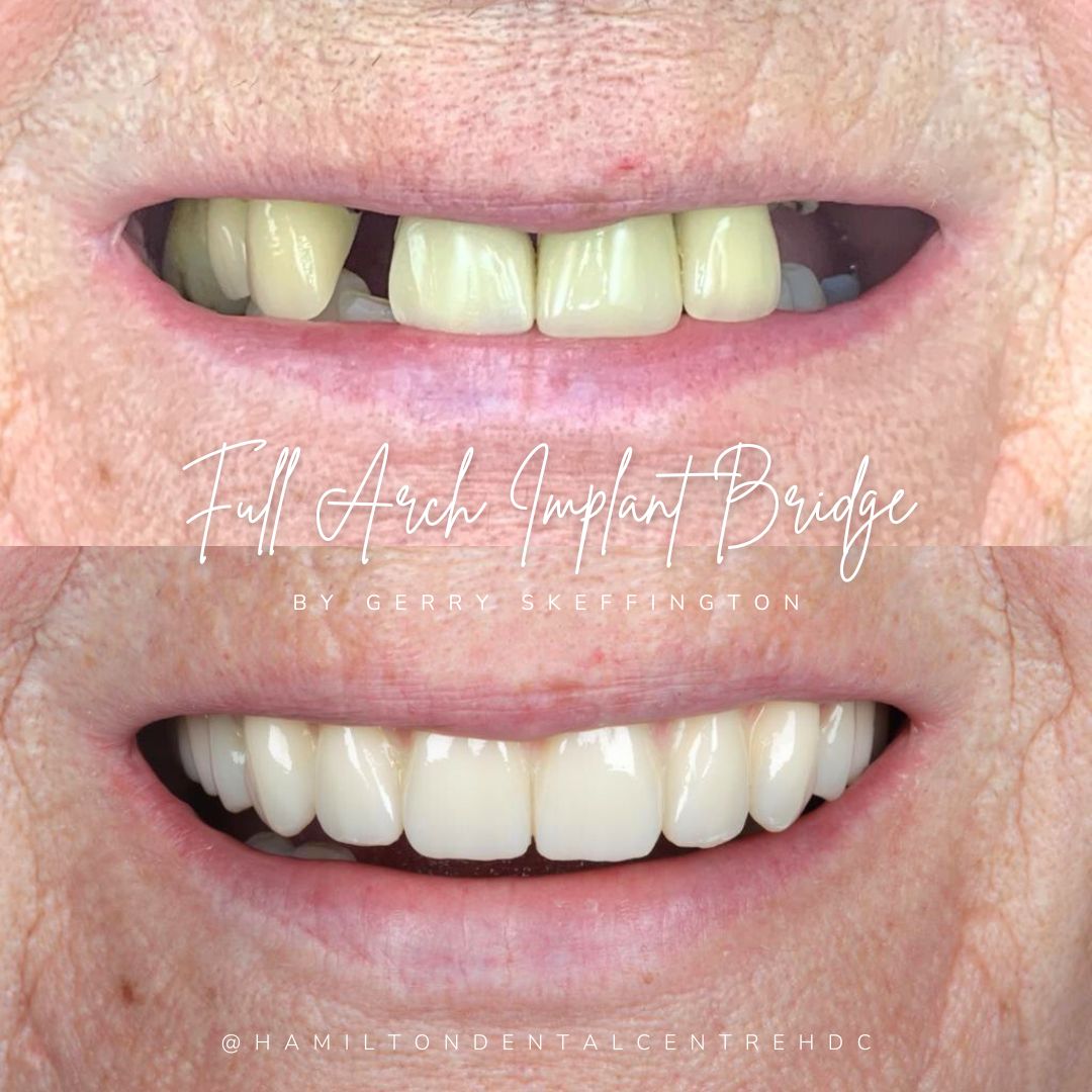 Hamilton Dental Centre Hamilton Dental Centre