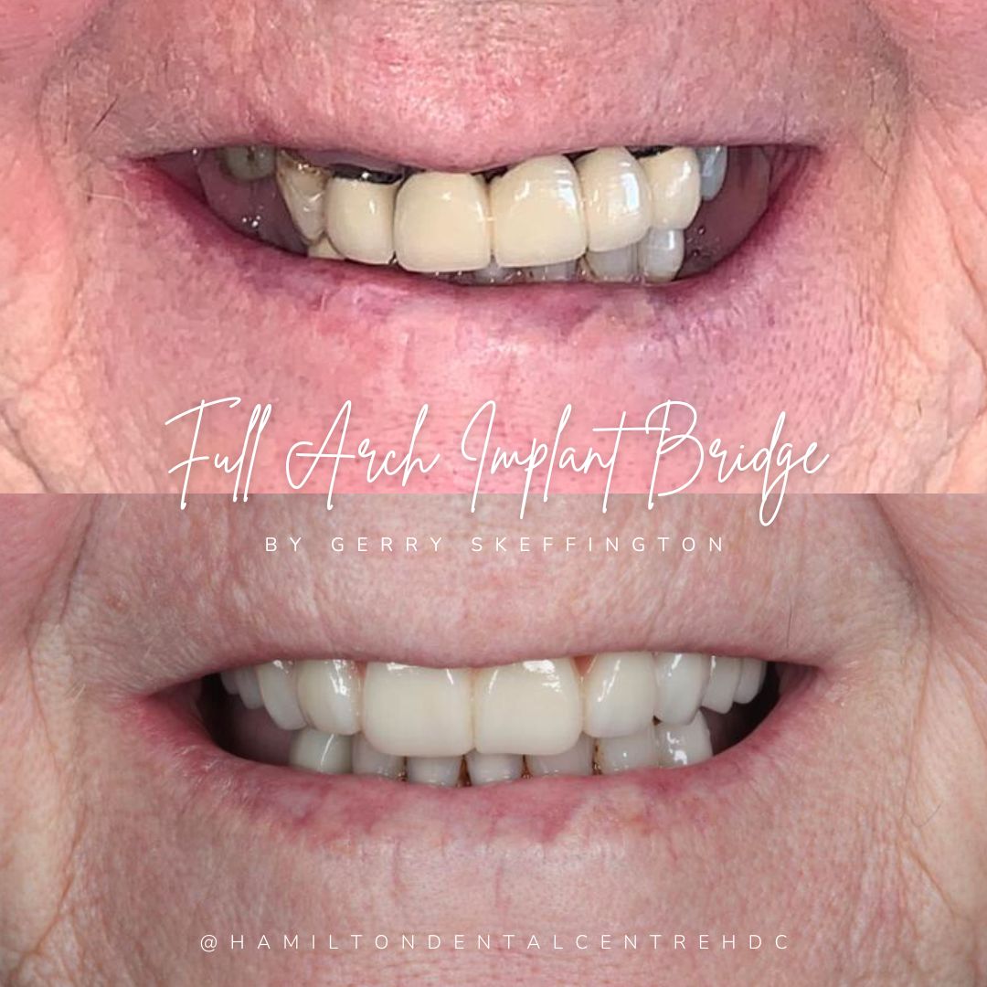 Hamilton Dental Centre Hamilton Dental Centre