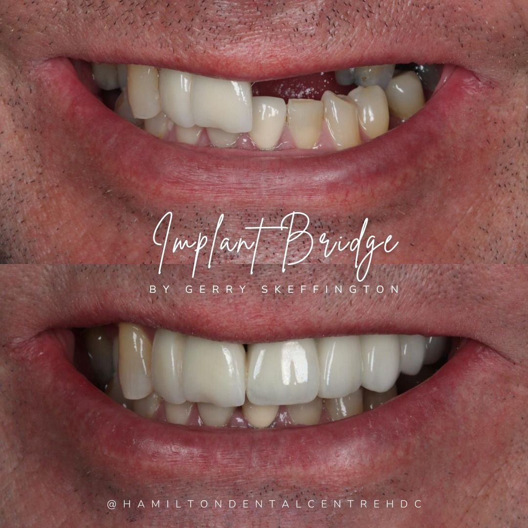 Hamilton Dental Centre Hamilton Dental Centre