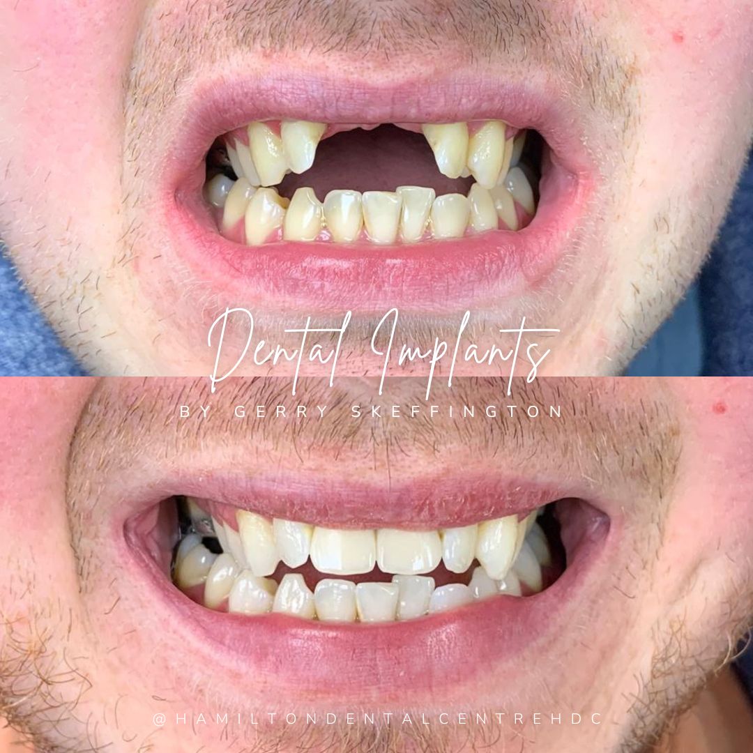 Hamilton Dental Centre Hamilton Dental Centre