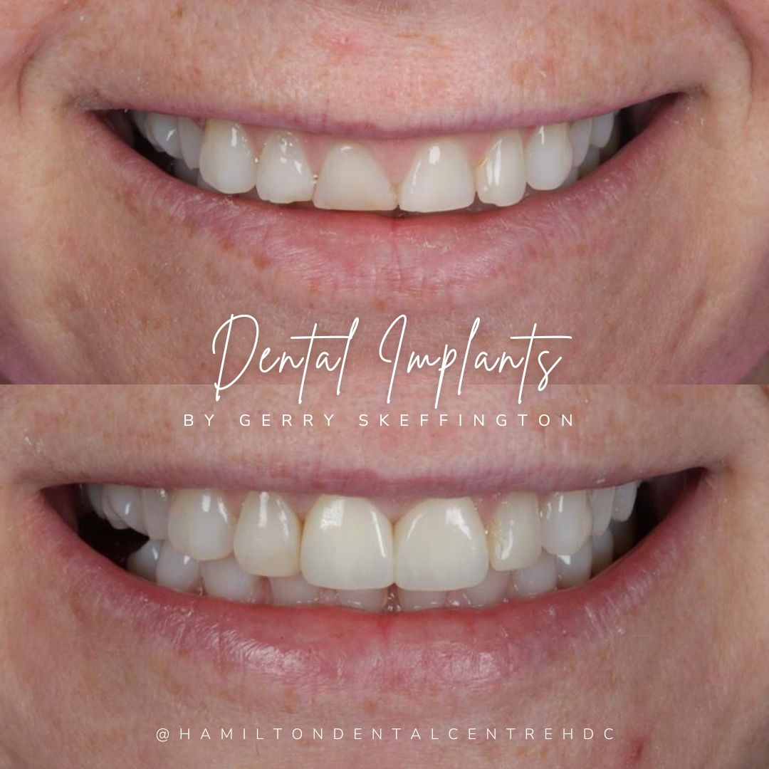 Hamilton Dental Centre Hamilton Dental Centre