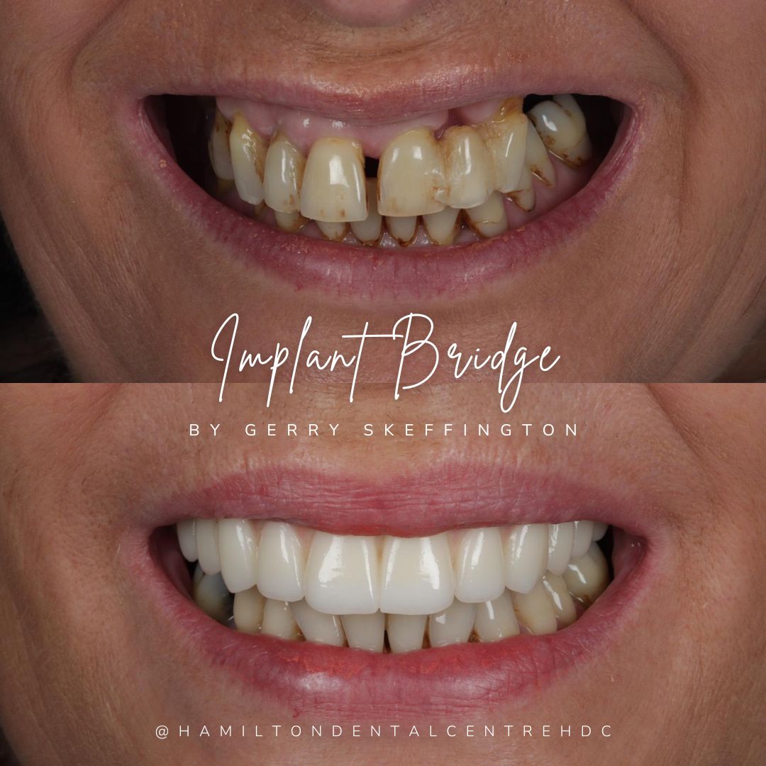 Hamilton Dental Centre Hamilton Dental Centre