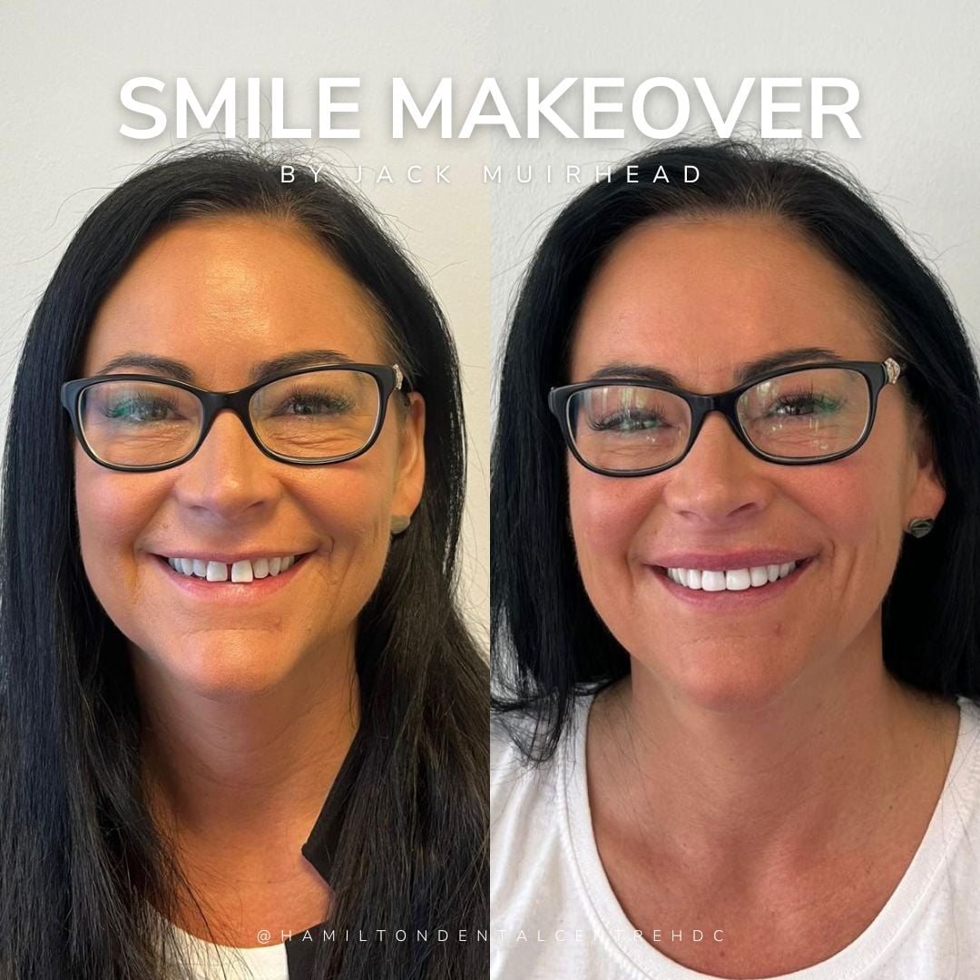 Dentist in Hamilton