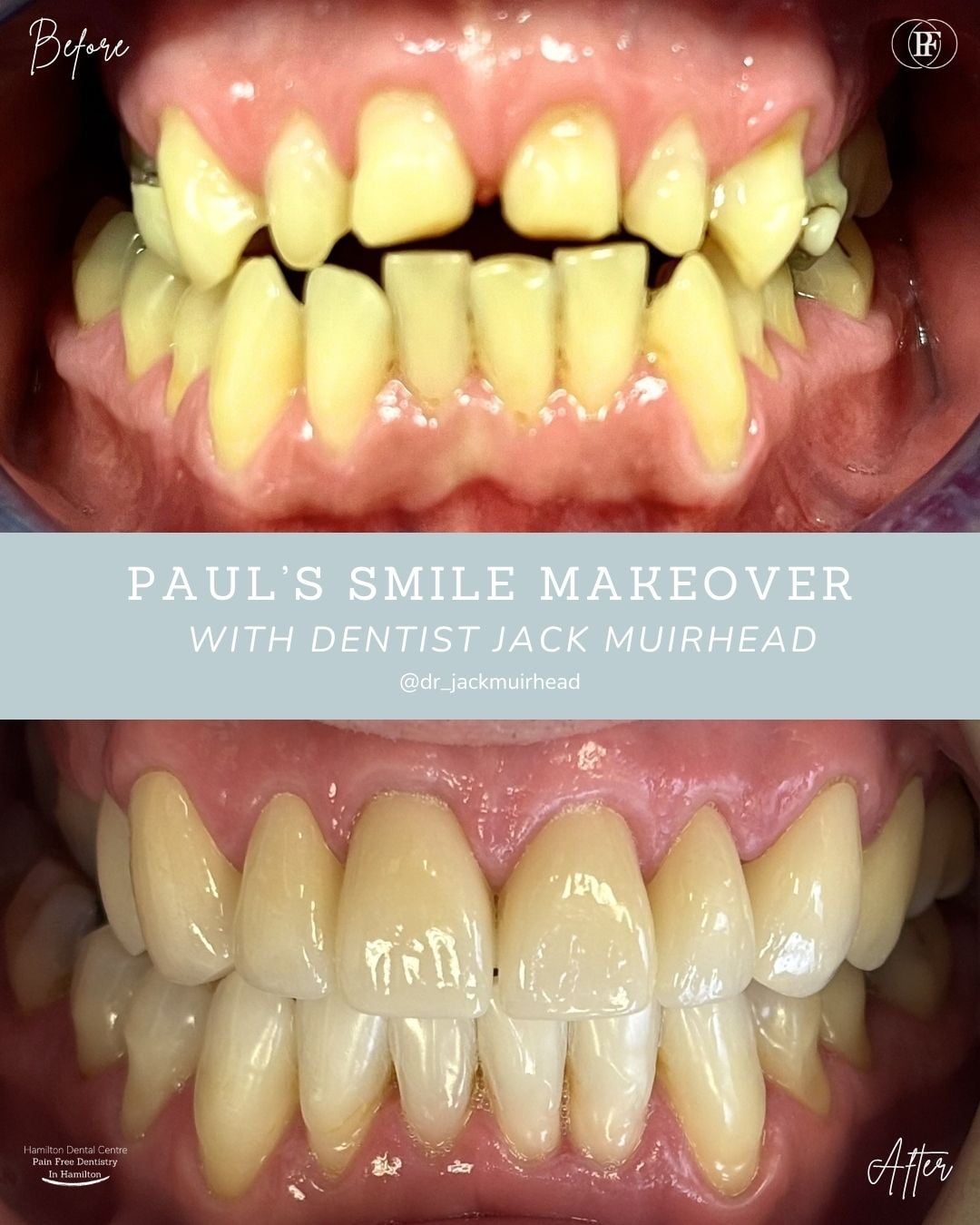 Hamilton Dental Centre Paul's Smile Story Ross's Smile Story with Andy