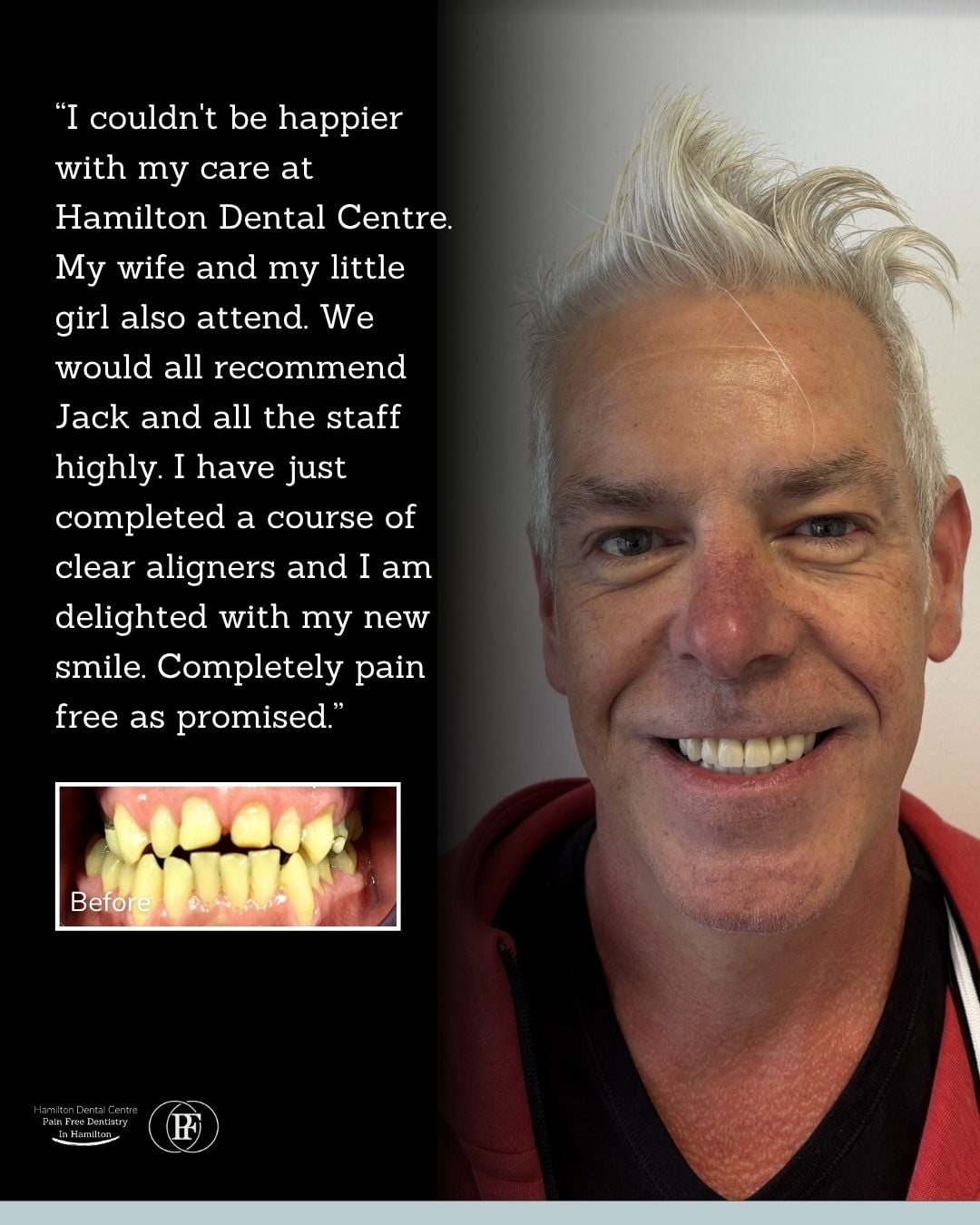 Hamilton Dental Centre Paul's Smile Story Ross's smile story